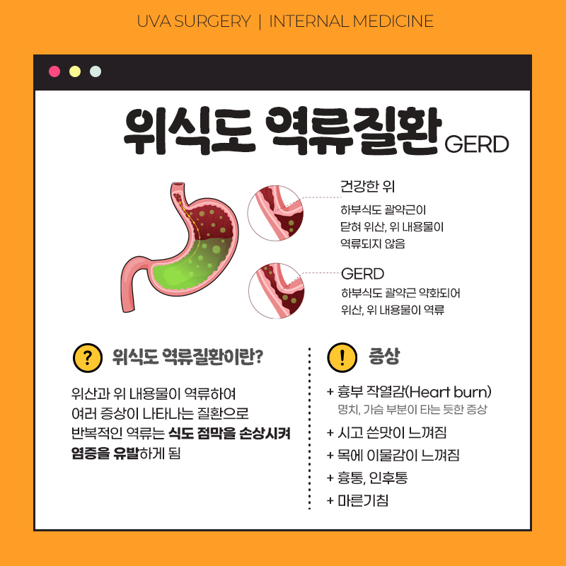 이미지 2