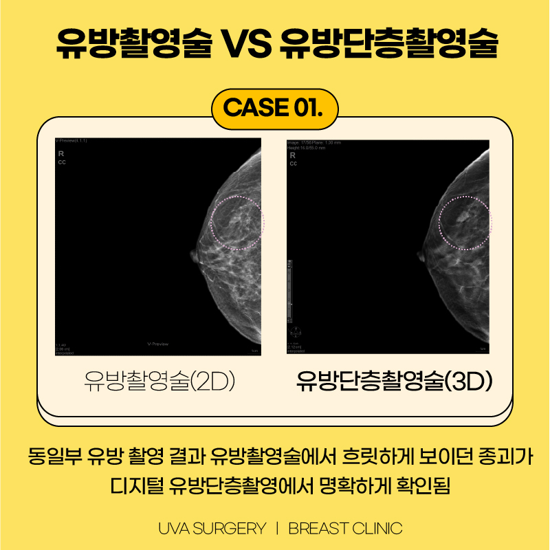 이미지 5