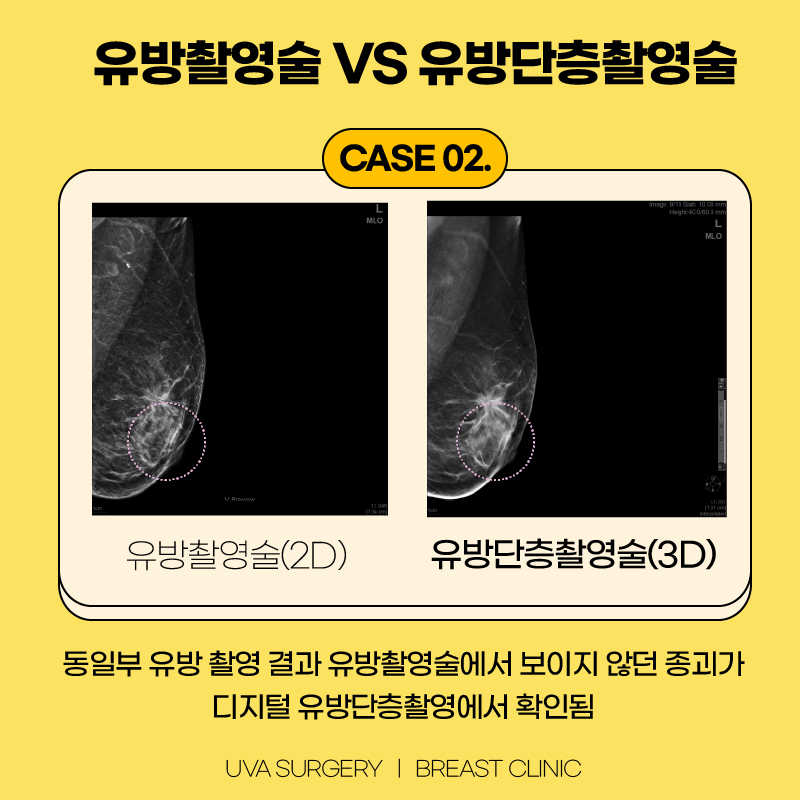 이미지 7