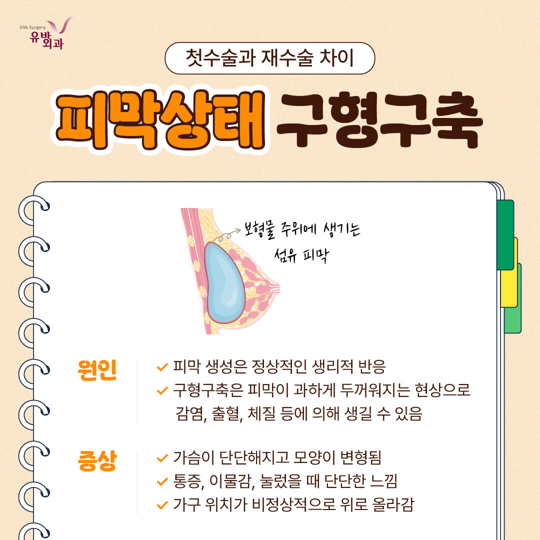 이미지 2